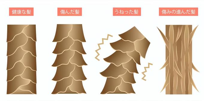 髪のダメージの４つのイラスト